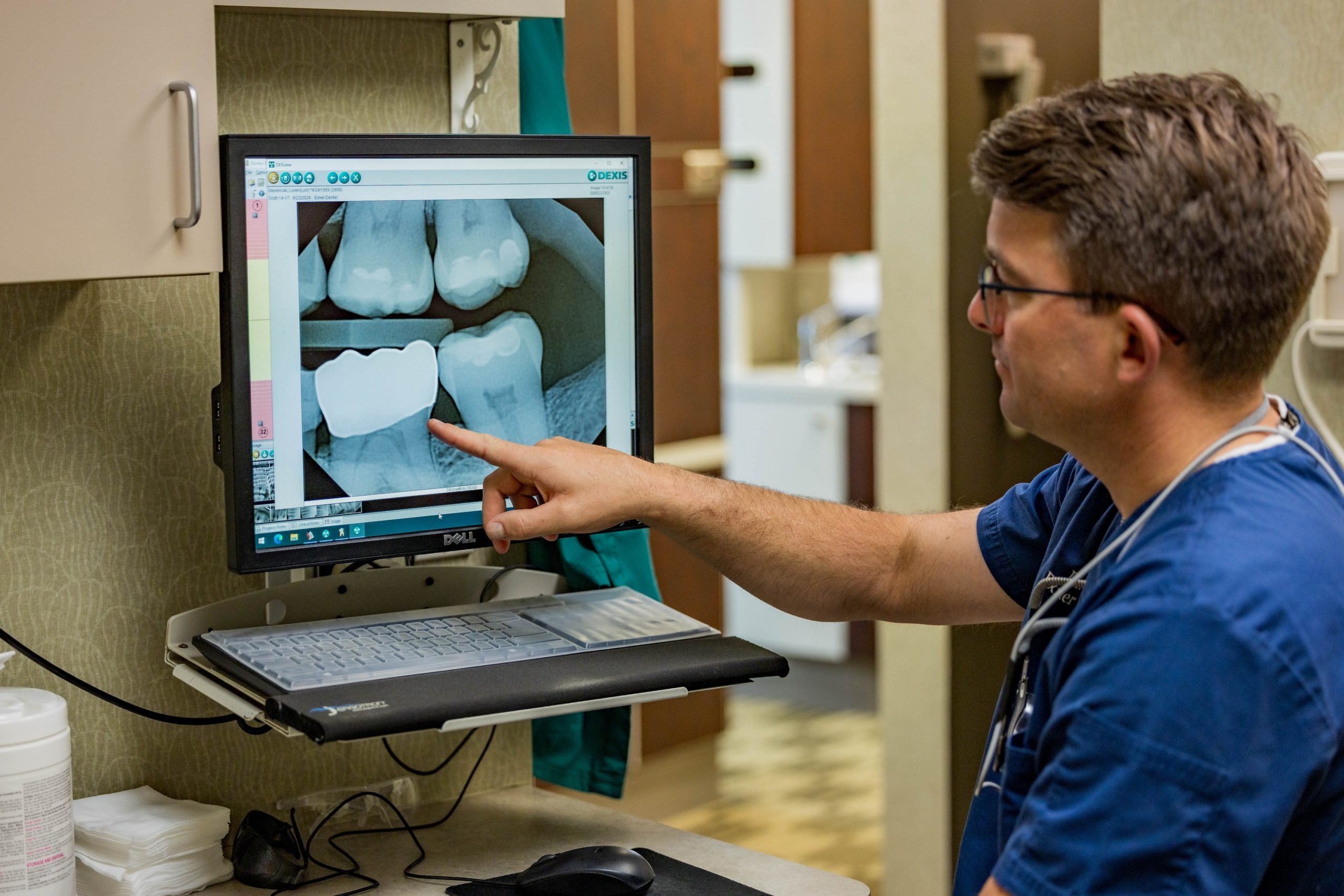 Tooth Extractions